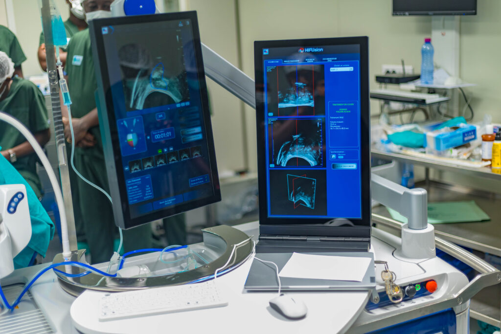 moniteur montrant des images de prostate